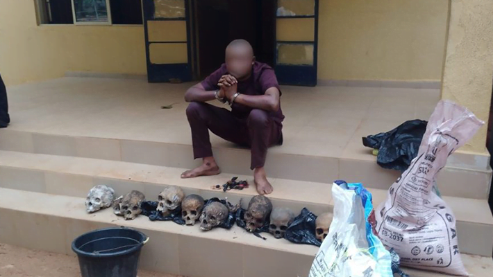 Ritualist Caught With 8 Human Skulls Priced At ₦30,000 Each In Ondo (Photos)