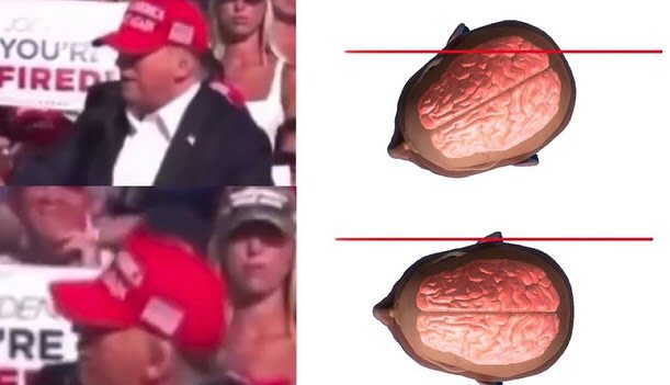 How A Millisecond Head Tilt Saved Donald Trump’s Life (Video)