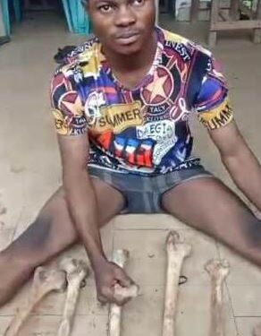 Police Nabs Herbalist With 11 Human Bones In Anambra