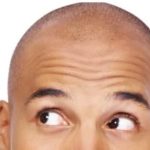 5 genius ways to hide a bald patch