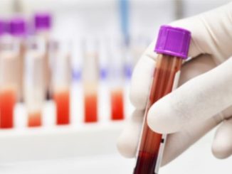 This blood type is so rare that only 43 people have it in the world