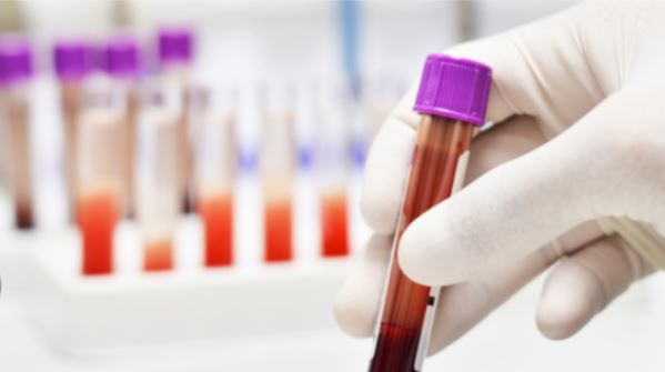 This blood type is so rare that only 43 people have it in the world